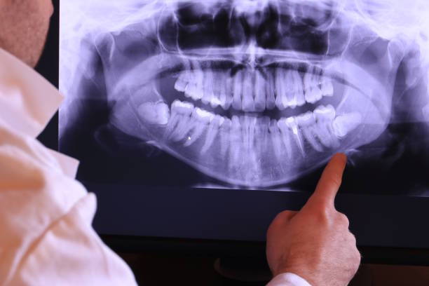 Best Emergency Dental Extractions in Mangonia Park, FL