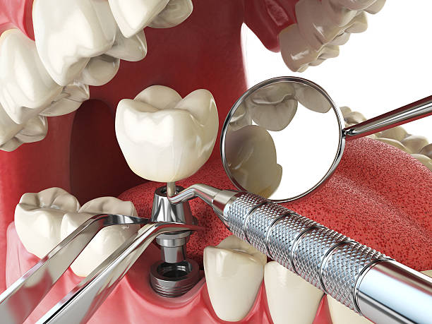 Best Emergency Dental Care for Abscessed Tooth in Mangonia Park, FL